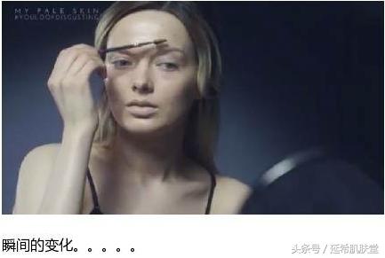 “你如果不长痘一定很好看”——长痘患者的自述