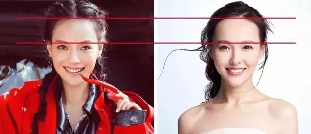 发际线不好看怎么剪,如何拯救90后的发际线