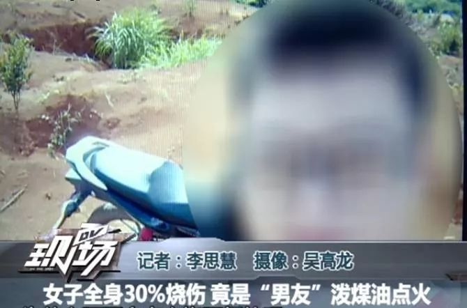 女大学生向男生泼热水致二度烧伤,16岁少女被泼汽油