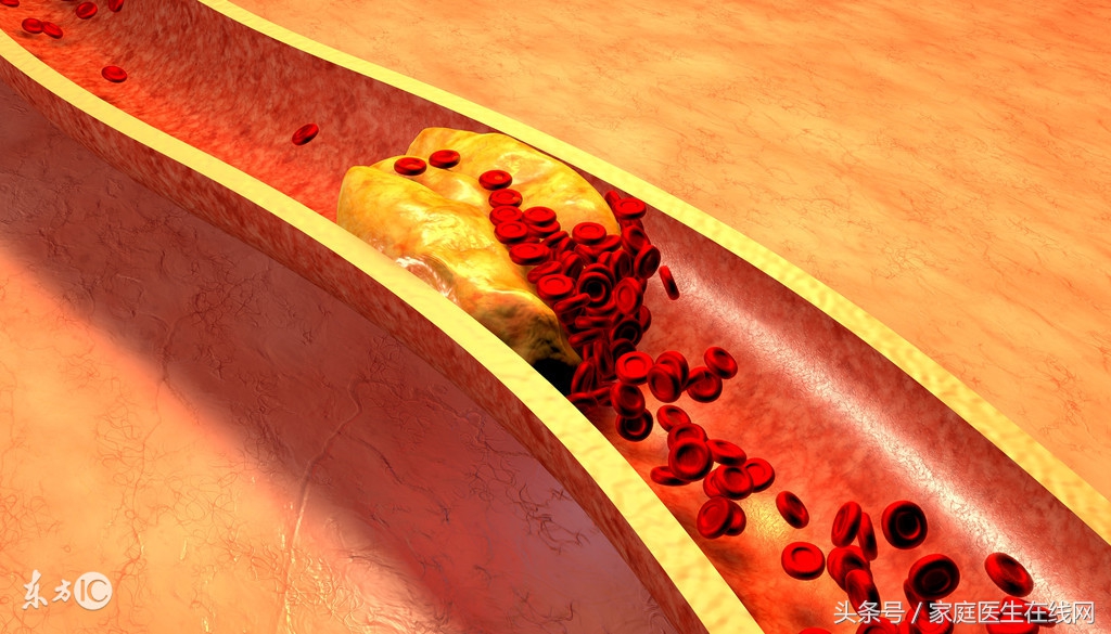 医生提醒这3件事比熬夜还要伤肝,癌细胞最怕你做这5件事