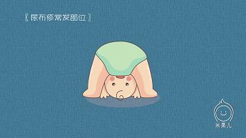 宝宝身上出现疹子该如何处理,如何分辨宝宝身上的疹子