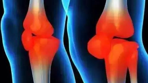 就医搜｜潮湿的环境会诱发风湿热吗？风湿热有哪些症状？