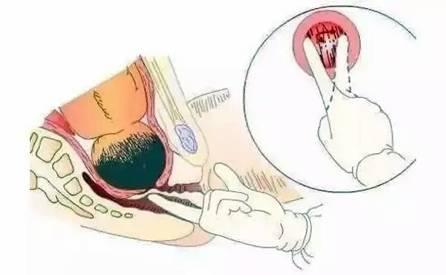 临产前半个小时，胎儿在干什么？太神奇太可爱了！