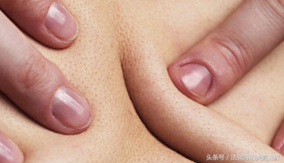 医美如何祛痘坑和痘印,医美护肤小知识问答祛痘