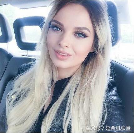 “你如果不长痘一定很好看”——长痘患者的自述