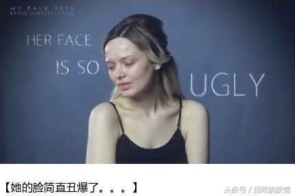 “你如果不长痘一定很好看”——长痘患者的自述