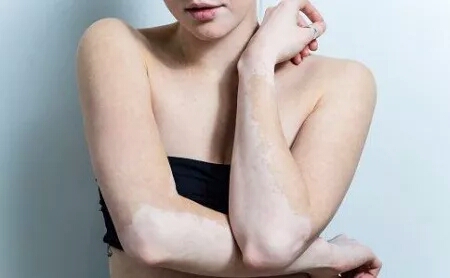 内裤穿得久了是不是有病菌,你的裤子穿几年了