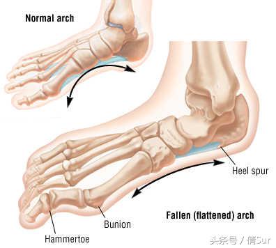 简单几步解决恼人的脚底板酸痛,怎样缓解脚底板的肌肉酸痛