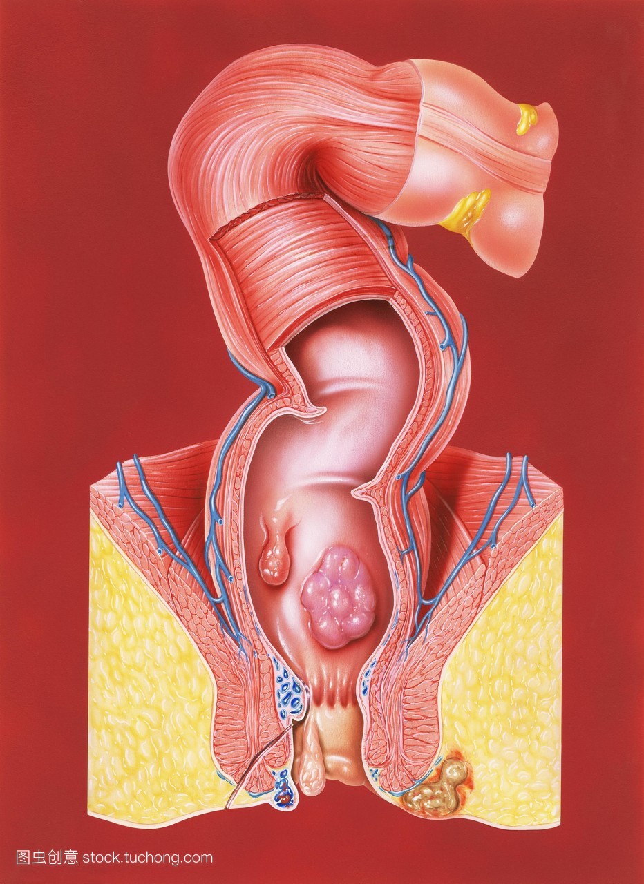 大便次数增多大便变细有血,大便次数多还带黏液怎么办