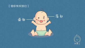 宝宝身上出现疹子该如何处理,如何分辨宝宝身上的疹子