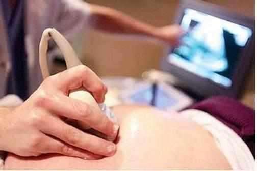 大月份胎停孕妈妈如何调整心态,孕妇4个月胎停药流要注意什么