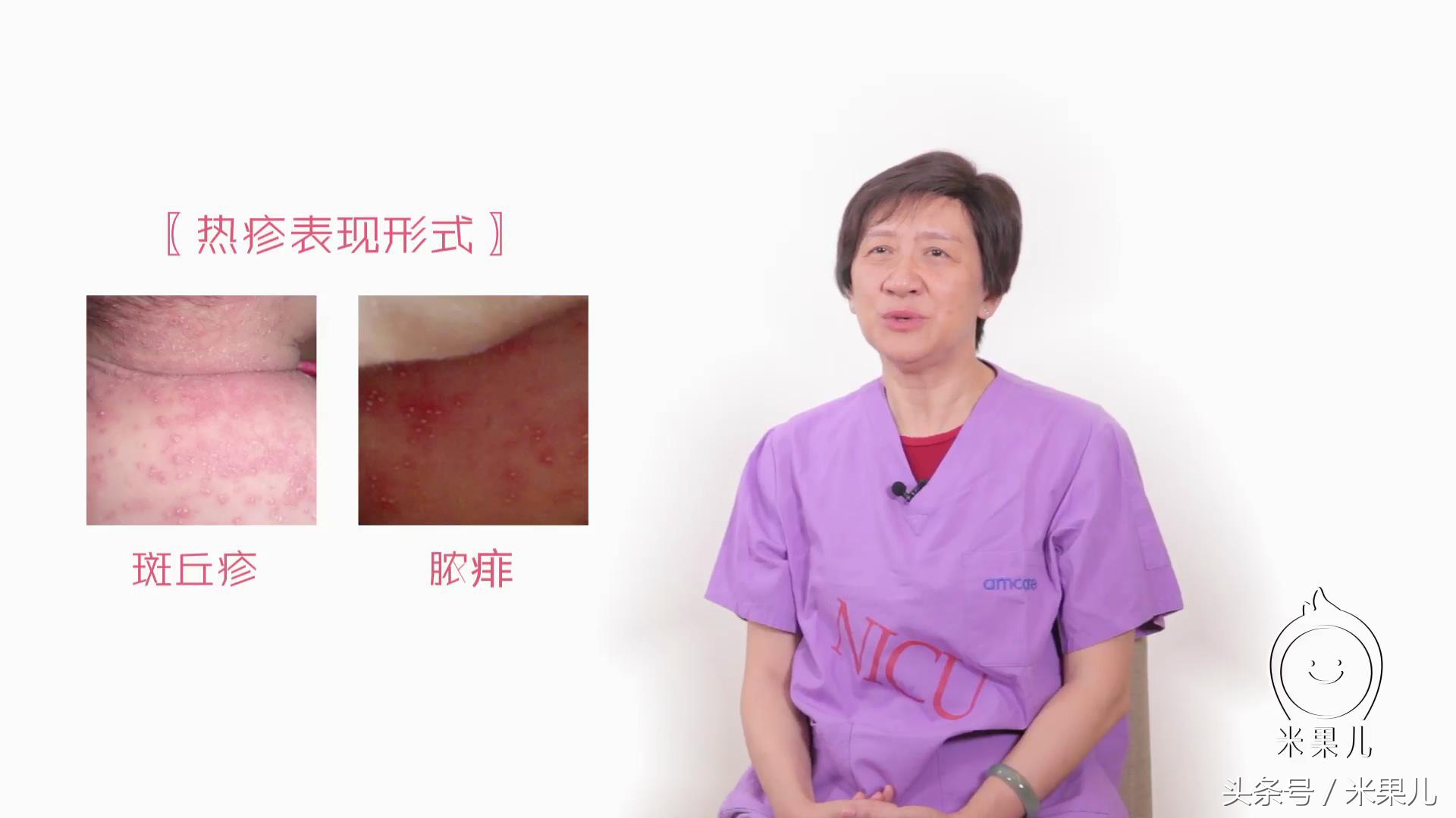 宝宝身上出现疹子该如何处理,如何分辨宝宝身上的疹子