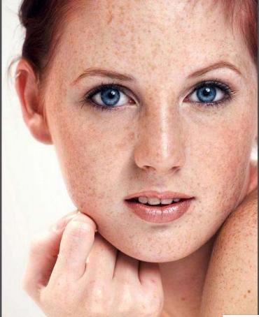 杨老师教你祛斑,杨老师专业祛斑祛痘