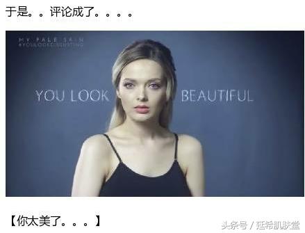 “你如果不长痘一定很好看”——长痘患者的自述