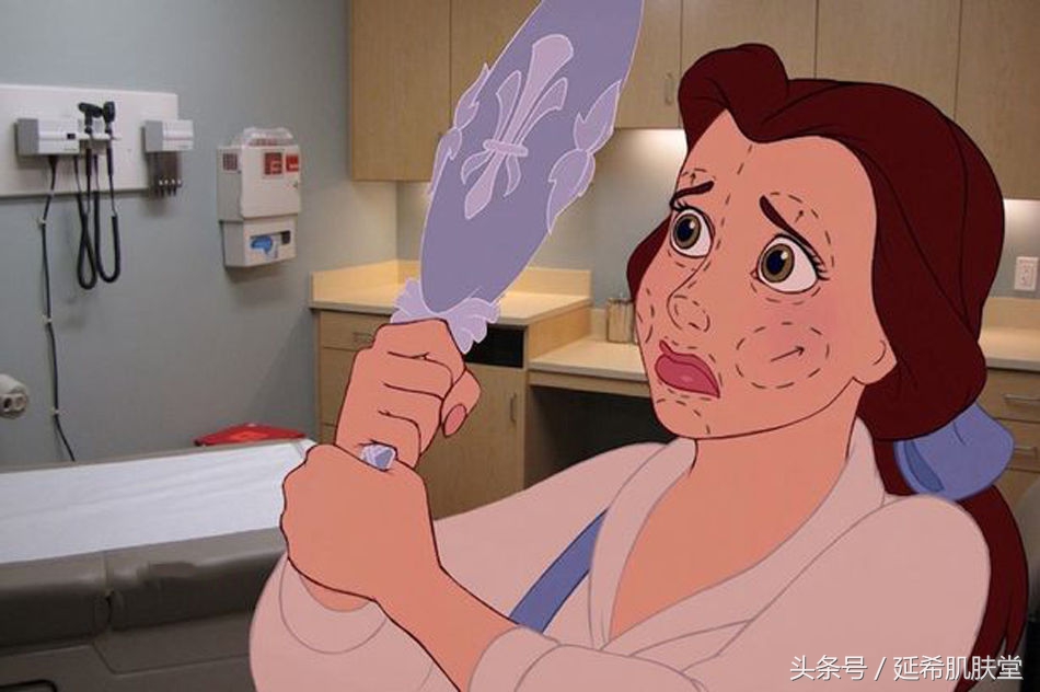 “你如果不长痘一定很好看”——长痘患者的自述