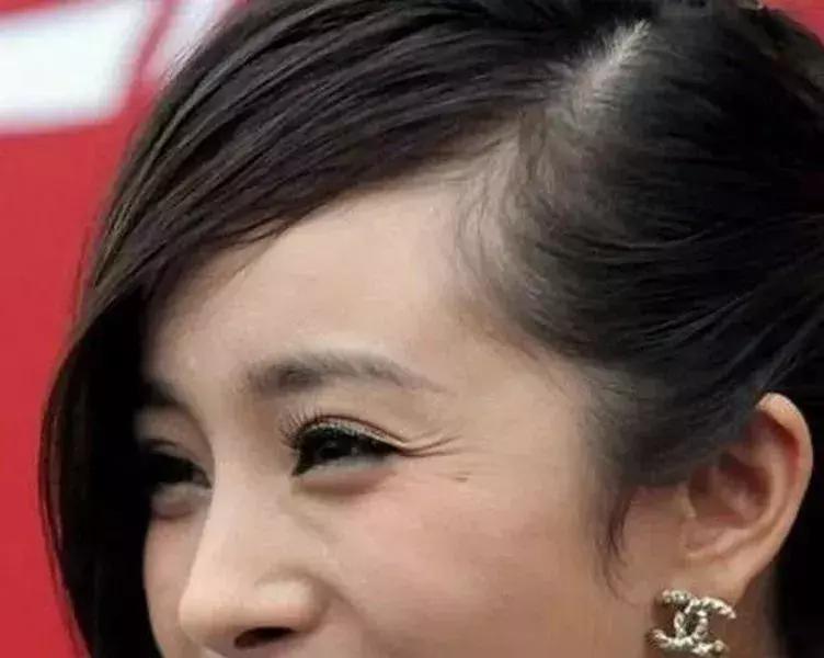 眼部细纹最好用的眼霜,对眼部细纹有效的眼霜