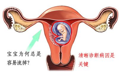 黄帝内经人工流产后不孕,人工流产可能导致的后果