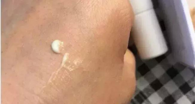 眼部细纹最好用的眼霜,对眼部细纹有效的眼霜