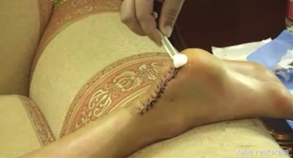 想要在体育界成功有多难，看了哈登的脚趾刘翔的跟腱你就懂