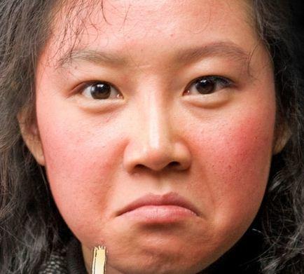 冬季脸蛋容易发红发烫,你可以这样护理皮肤