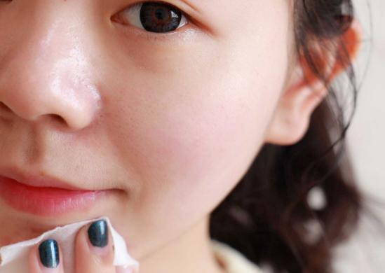 冬季脸蛋容易发红发烫,你可以这样护理皮肤