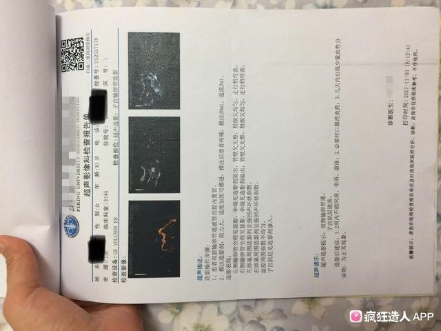 为了好孕,我连午休都在自“虐”