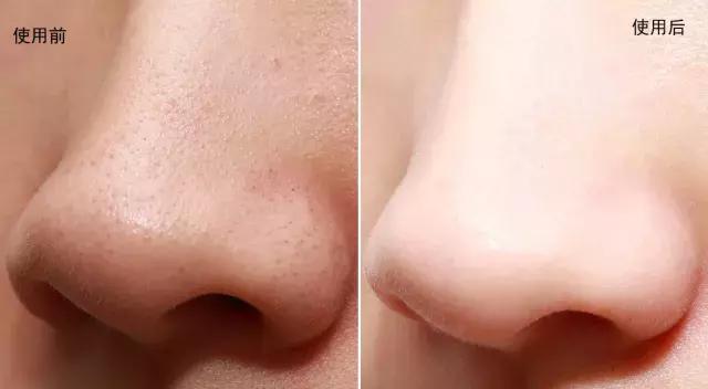 敏感肌卸妆洁面乳,适合敏感肌用的去角质洁面乳