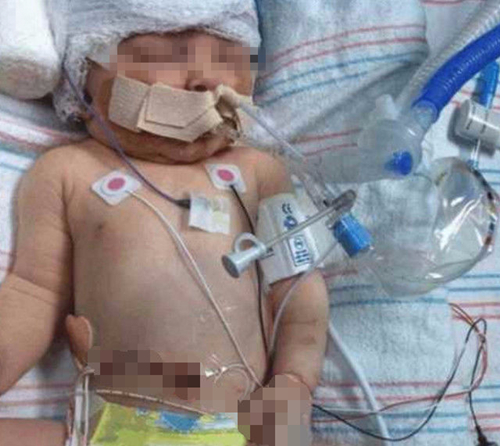 婴儿7天没拉大便了怎么办,婴儿七天没拉粑粑啥子情况