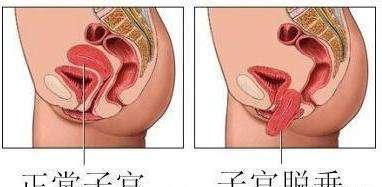 22岁孕妇生产后3天死亡,27岁孕妇顺产生孩子