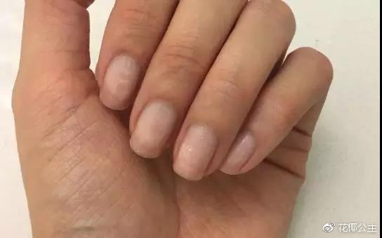 指甲薄脆易断做美甲怎么做,做美甲一般是哪个手指容易劈