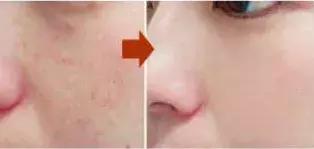 敏感肌卸妆洁面乳,适合敏感肌用的去角质洁面乳