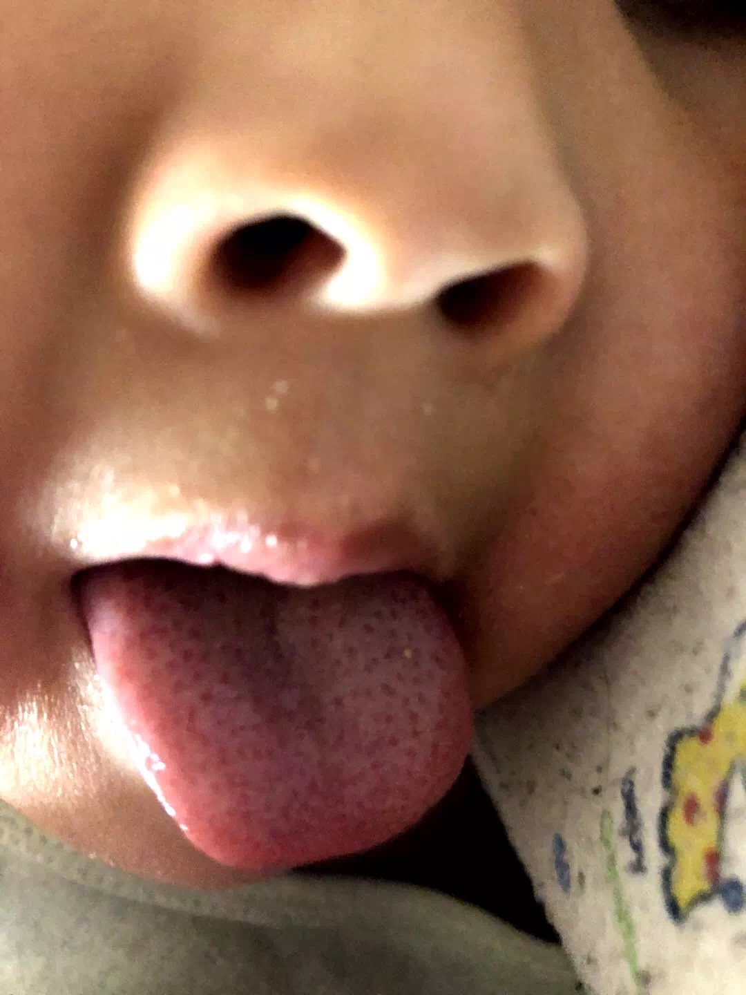 根据舌苔辨别身体情况,舌苔白厚什么原因吃什么中成药