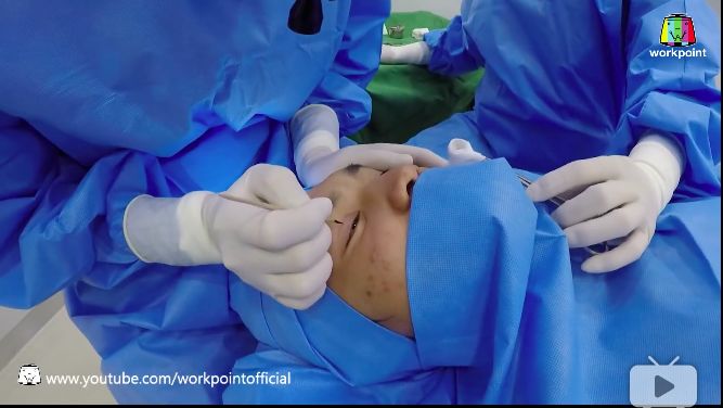 泰国整形节目叫什么,泰国整形填充额头