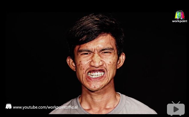 泰国整形节目叫什么,泰国整形填充额头