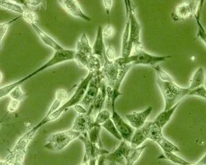 科普:皱纹成因,以及对抗方法