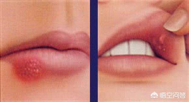 啥是上火,吃点辣椒就上火是什么原因