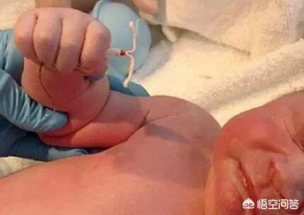 女性上环的好处及坏处,女性结扎和上环的好处及坏处