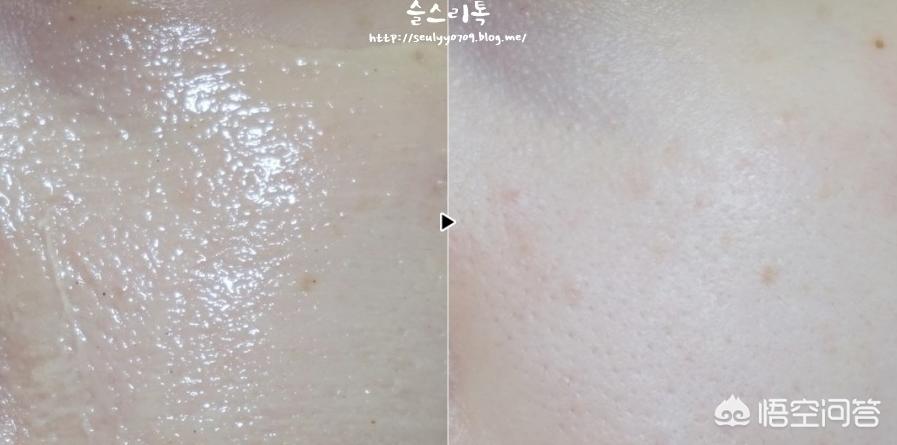 清洁黑头收缩毛孔的最好办法,清洁黑头收缩毛孔是真的吗