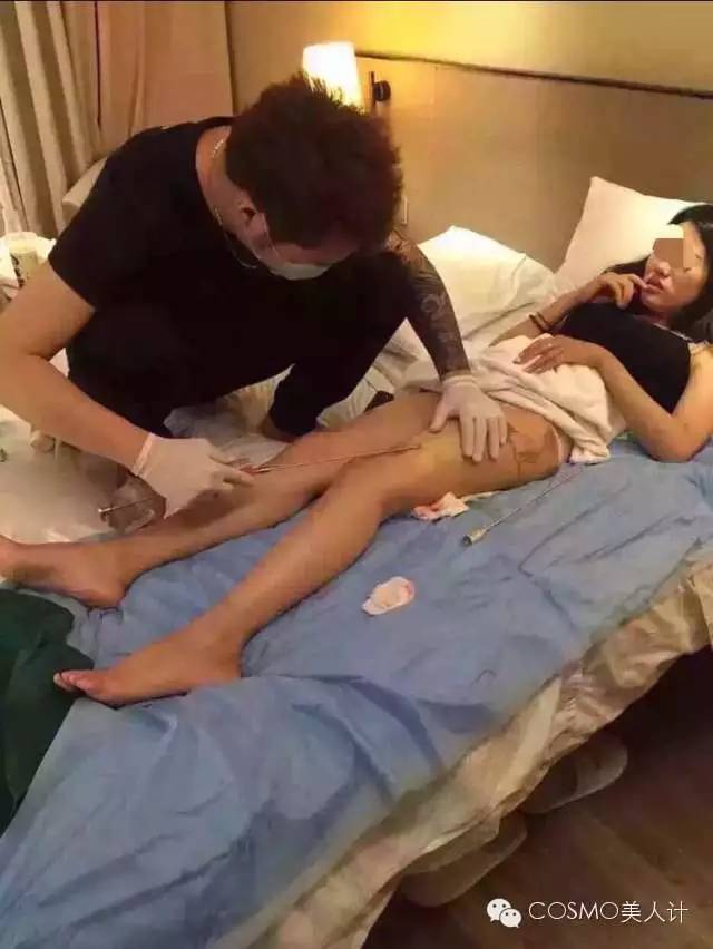 拿鸡腿练习双眼皮,拿鸡腿练双眼皮