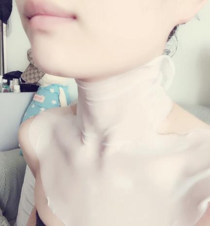 消除身上草莓印的最快方法,消除草莓印的最快方法嘴巴上