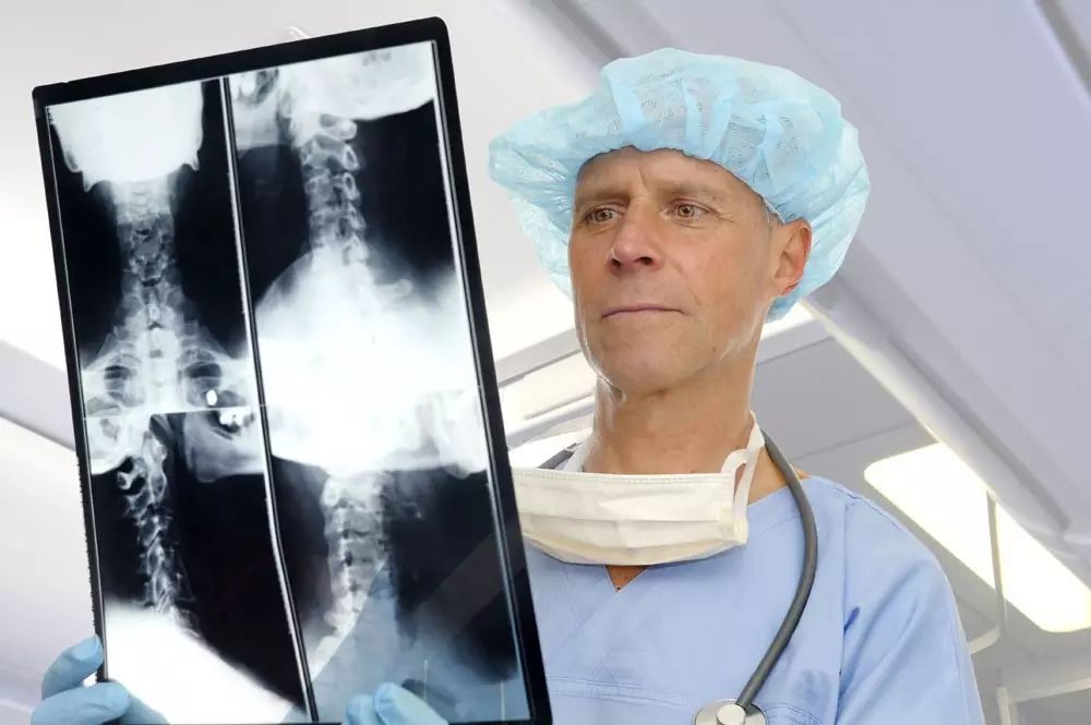 关于颈椎病的那些事儿……