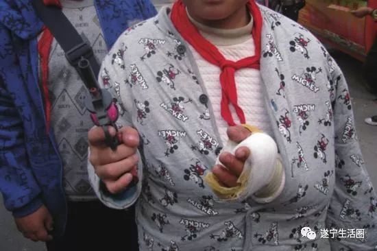 蓬溪一学生耍玩具枪“走火”手烧伤,店主承担一半医疗费