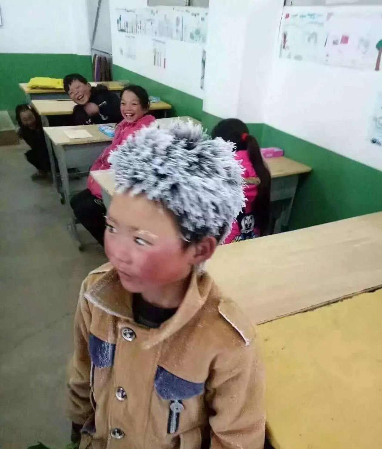 严重冻疮的快速消除方法,冻疮怎么预防护理