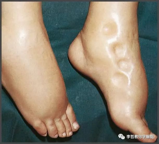 肌肉疼痛是该锻炼还是松解,肌肉的疼痛感是通过什么来控制