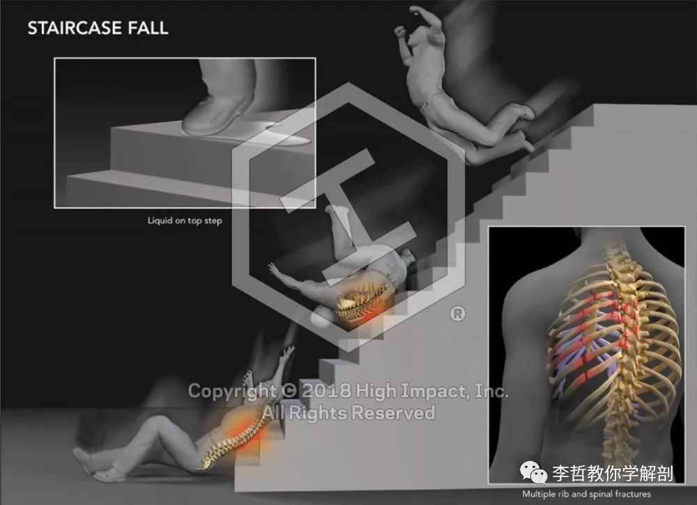 肌肉疼痛是该锻炼还是松解,肌肉的疼痛感是通过什么来控制