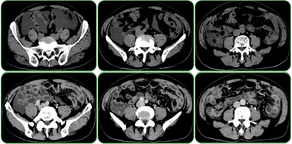 同为同龄人命运各不同,同为双胞胎命运却不同