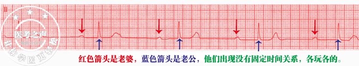 心电图秒懂,心电图零基础都秒懂