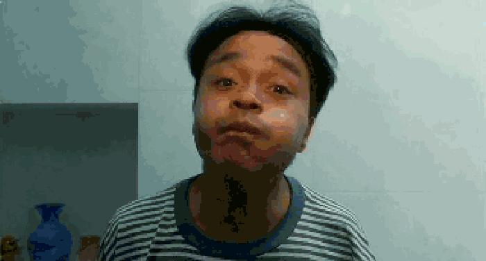 冬天感冒了怎么办好得快,冬天感冒了吃什么药好得快