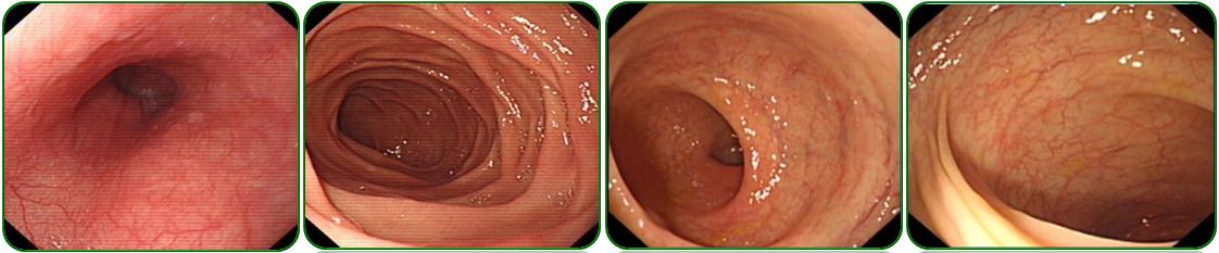 同为同龄人命运各不同,同为双胞胎命运却不同