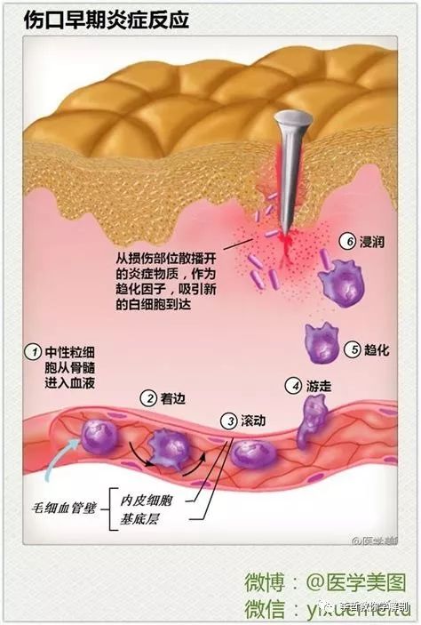 肌肉疼痛是该锻炼还是松解,肌肉的疼痛感是通过什么来控制